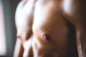 Adult Gynecomastia Surgery Nashville