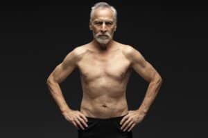 Senior Gynecomastia Surgery Nashville